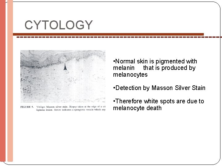 CYTOLOGY • Normal skin is pigmented with melanin that is produced by melanocytes •