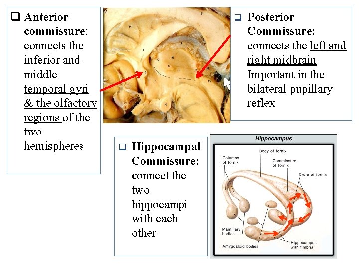 q Anterior commissure: connects the inferior and middle temporal gyri & the olfactory regions
