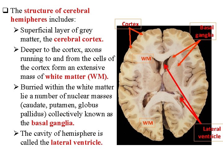 q The structure of cerebral hemipheres includes: Cortex Ø Superficial layer of grey matter,