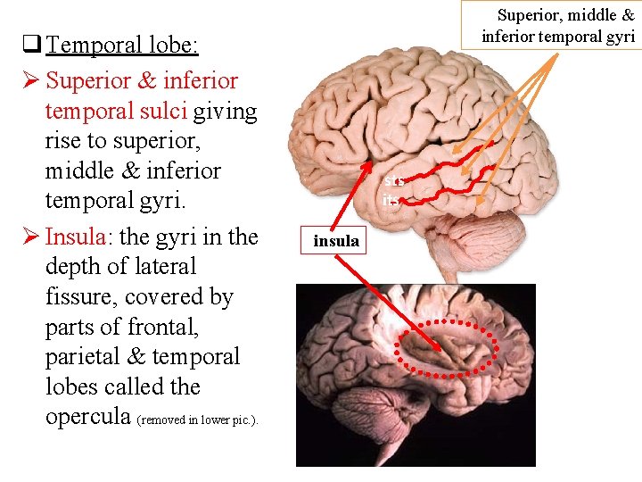 q Temporal lobe: Ø Superior & inferior temporal sulci giving rise to superior, middle