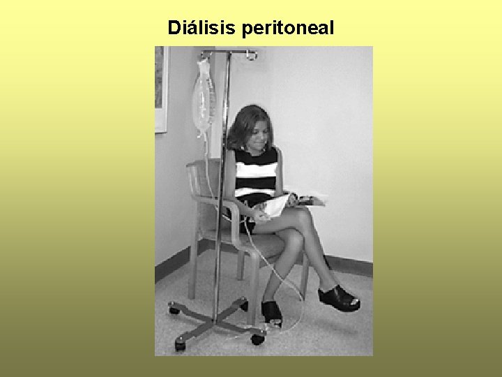 Diálisis peritoneal 