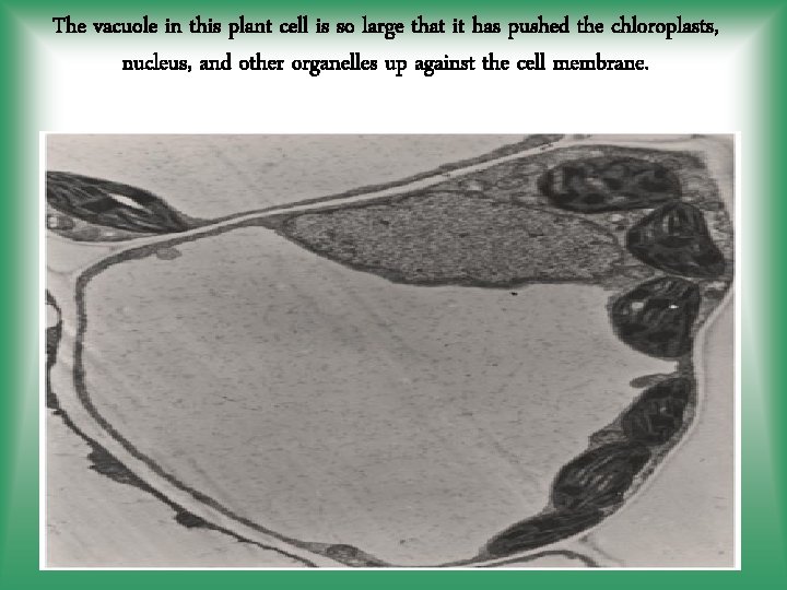 The vacuole in this plant cell is so large that it has pushed the