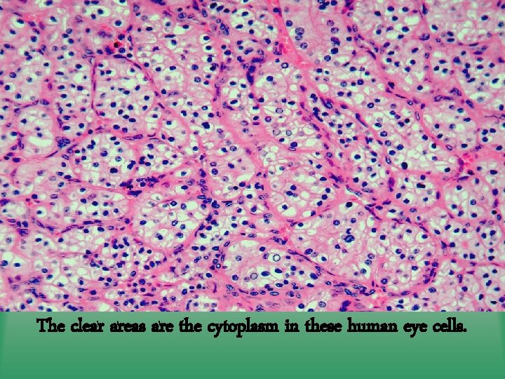 The clear areas are the cytoplasm in these human eye cells. 