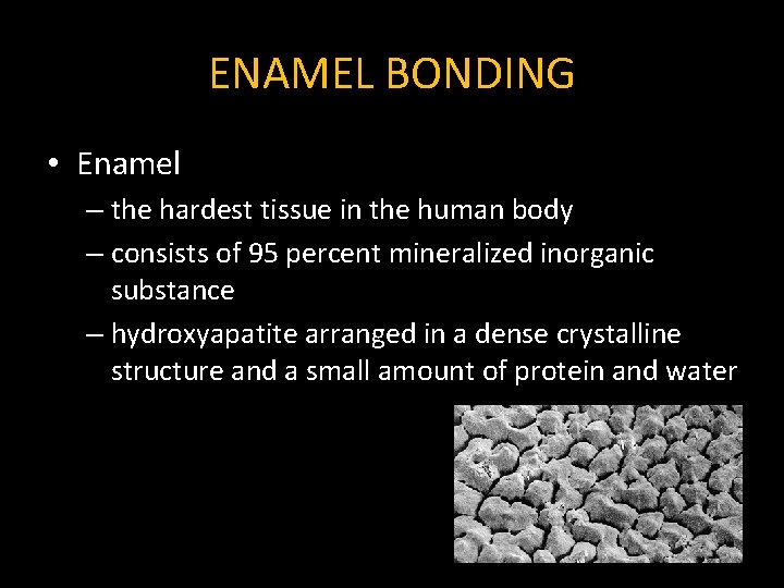 ENAMEL BONDING • Enamel – the hardest tissue in the human body – consists ENAMEL BONDING • Enamel – the hardest tissue in the human body – consists