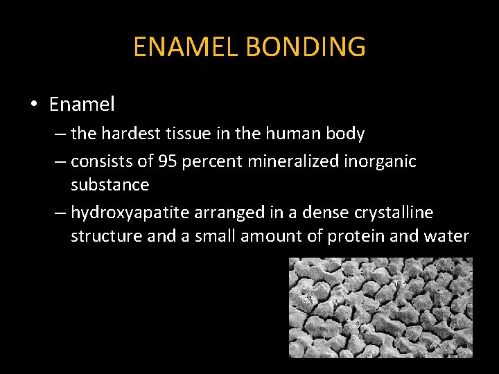 ENAMEL BONDING • Enamel – the hardest tissue in the human body – consists