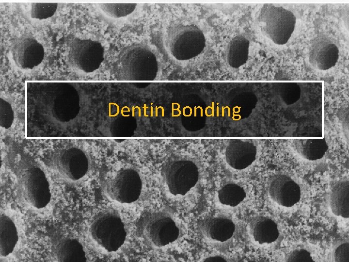 Dentin Bonding Dentin Bonding