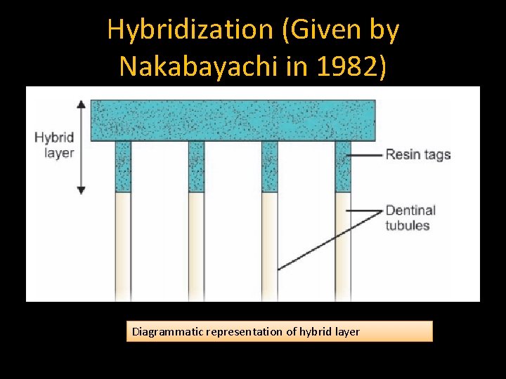 Hybridization (Given by Nakabayachi in 1982) Diagrammatic representation of hybrid layer 