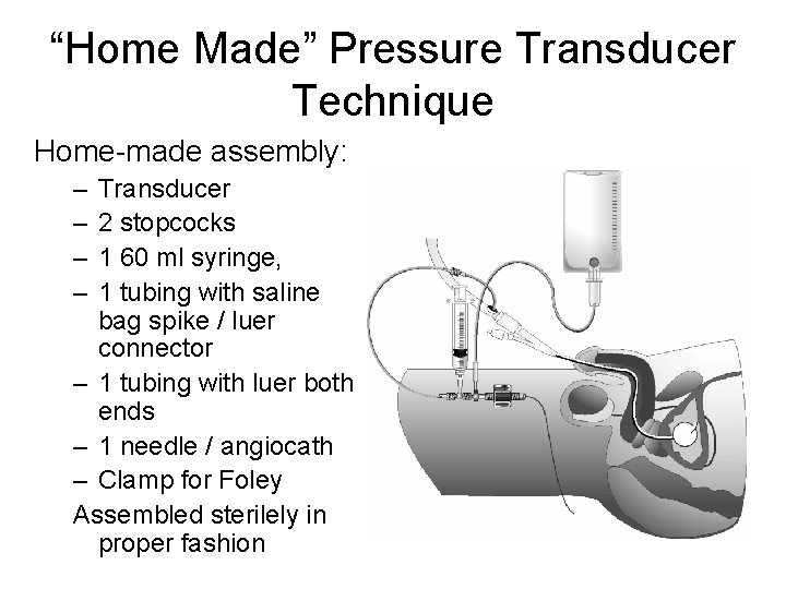 “Home Made” Pressure Transducer Technique Home-made assembly: – – Transducer 2 stopcocks 1 60