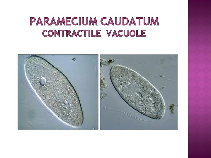 PARAMECIUM CAUDATUM CONTRACTILE VACUOLE 