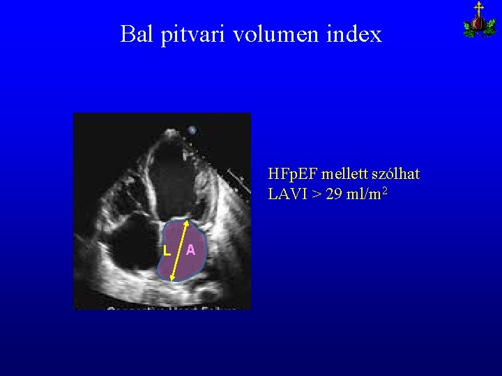 Bal pitvari volumen index HFp. EF mellett szólhat LAVI > 29 ml/m 2 L