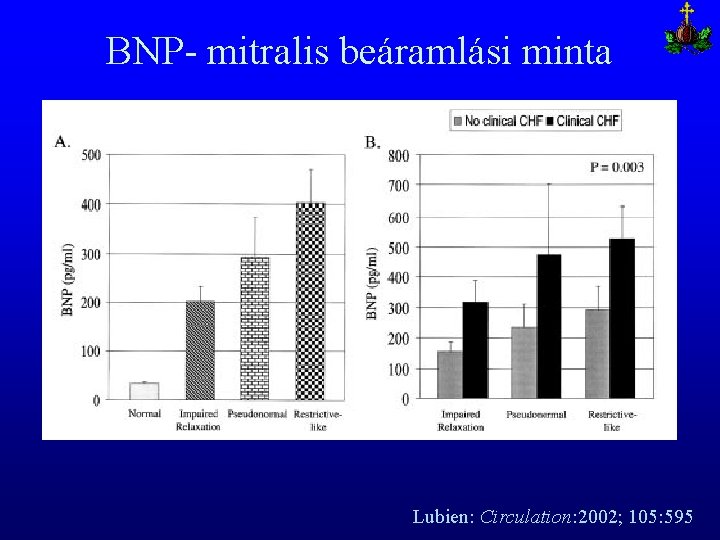 BNP- mitralis beáramlási minta Lubien: Circulation: 2002; 105: 595 