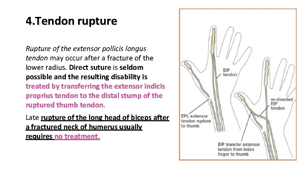 4. Tendon rupture Rupture of the extensor pollicis longus tendon may occur after a