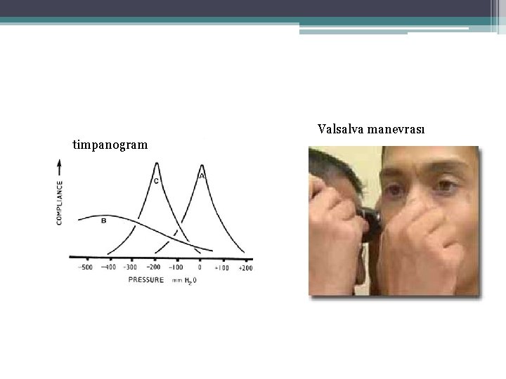 Valsalva manevrası timpanogram 