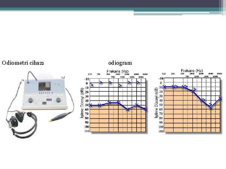 Odiometri cihazı odiogram 