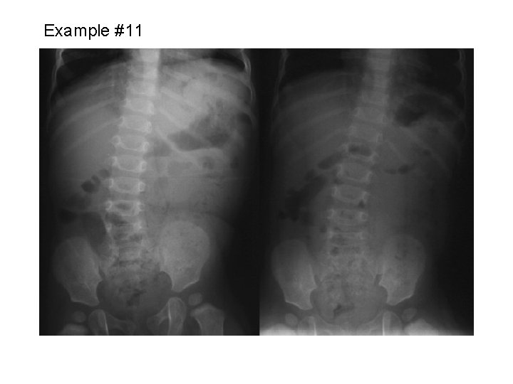 Example #11 