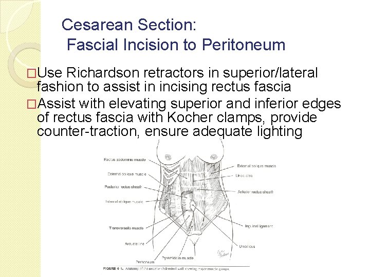 Cesarean Section: Fascial Incision to Peritoneum �Use Richardson retractors in superior/lateral fashion to assist Cesarean Section: Fascial Incision to Peritoneum �Use Richardson retractors in superior/lateral fashion to assist
