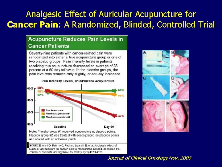  Analgesic Effect of Auricular Acupuncture for Cancer Pain: A Randomized, Blinded, Controlled Trial