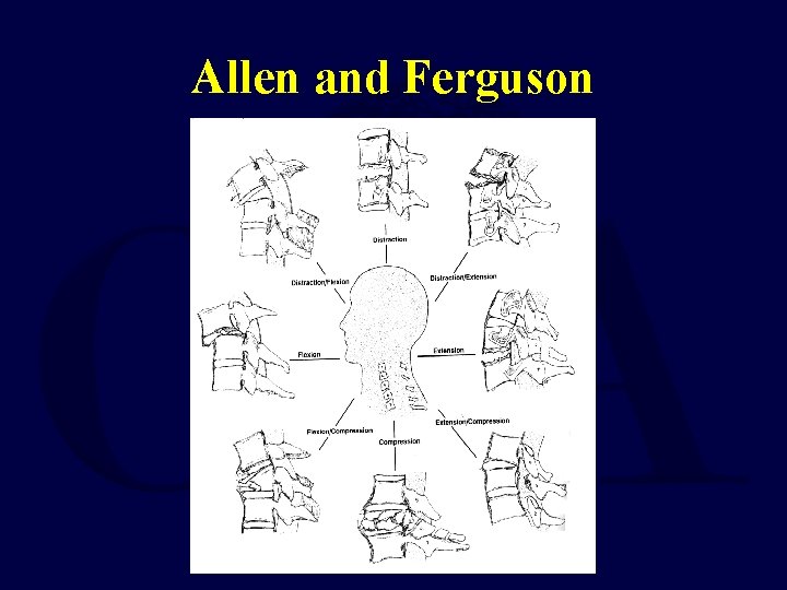 Allen and Ferguson 