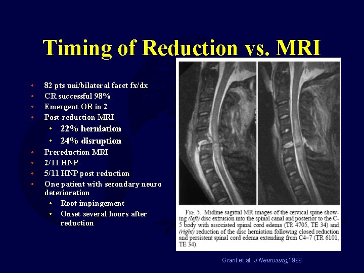 Timing of Reduction vs. MRI • • 82 pts uni/bilateral facet fx/dx CR successful