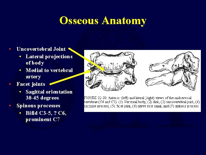 Osseous Anatomy • Uncovertebral Joint • Lateral projections of body • Medial to vertebral