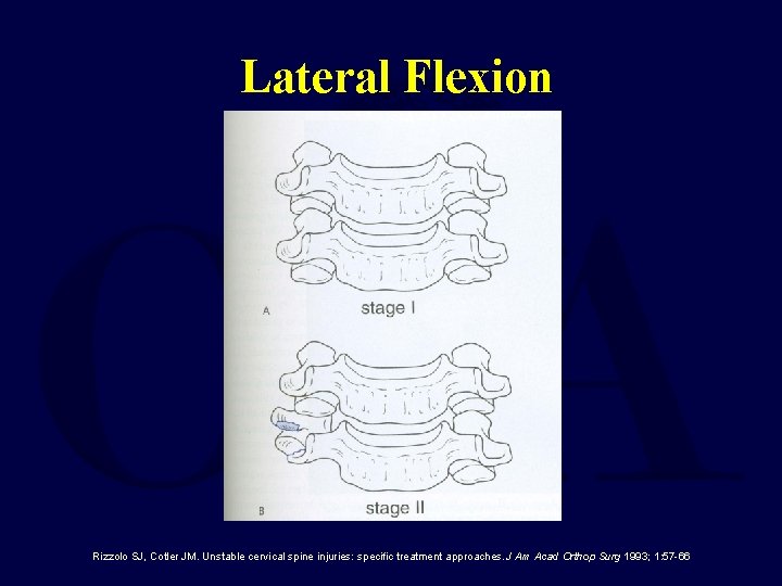 Lateral Flexion Rizzolo SJ, Cotler JM. Unstable cervical spine injuries: specific treatment approaches. J