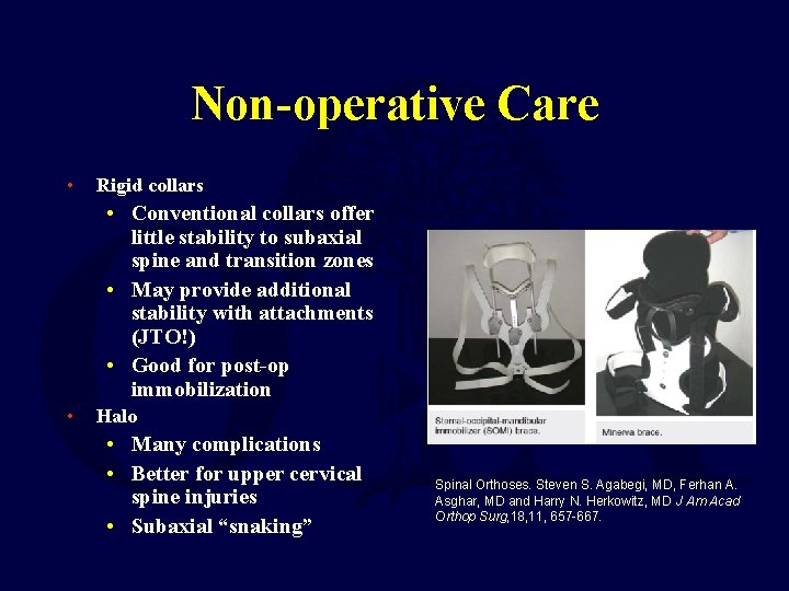 Non-operative Care • Rigid collars • Conventional collars offer little stability to subaxial spine