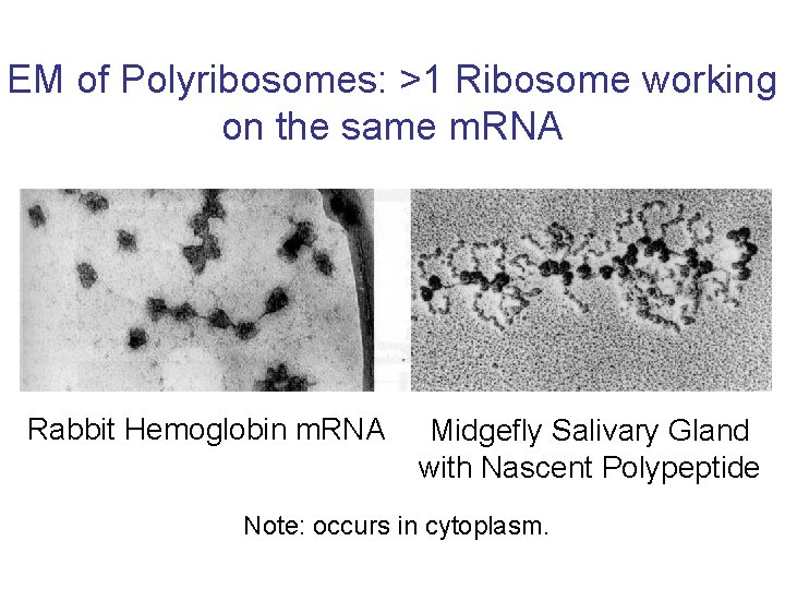 EM of Polyribosomes: >1 Ribosome working on the same m. RNA Rabbit Hemoglobin m.