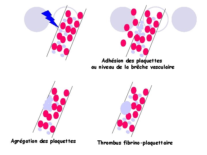 Adhésion des plaquettes au niveau de la brêche vasculaire Agrégation des plaquettes Thrombus fibrino-plaquettaire