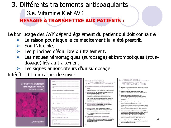 3. Différents traitements anticoagulants 3. e. Vitamine K et AVK MESSAGE A TRANSMETTRE AUX