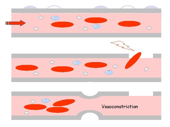 Vasoconstriction 