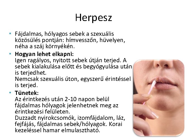 Herpesz • Fájdalmas, hólyagos sebek a szexuális közösülés pontján: hímvesszőn, hüvelyen, néha a száj