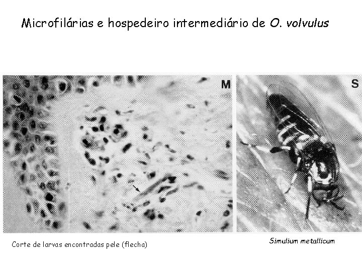 Microfilárias e hospedeiro intermediário de O. volvulus Corte de larvas encontradas pele (flecha) Simulium