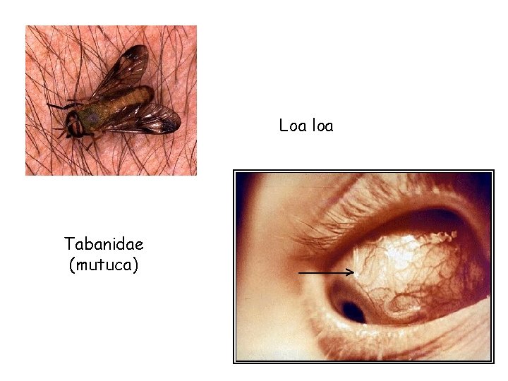 Loa loa Tabanidae (mutuca) 