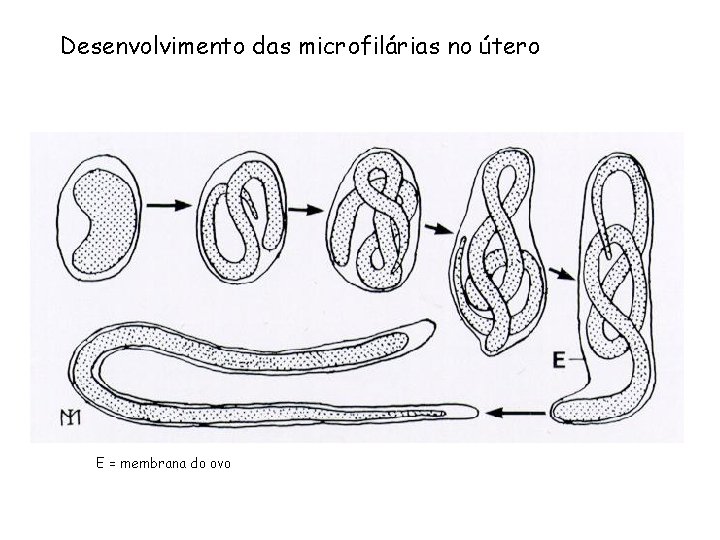 Desenvolvimento das microfilárias no útero E = membrana do ovo 