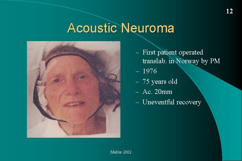 Acoustic Neuroma Vestibular Schwannoma Diagnosis and treatment Per