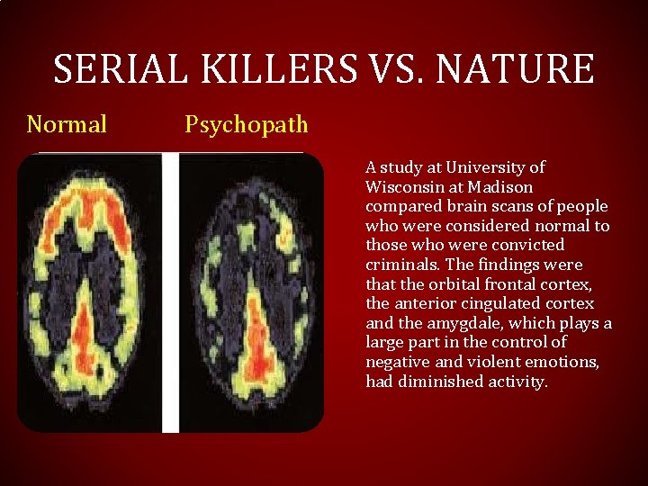 SERIAL KILLERS VS. NATURE Normal Psychopath A study at University of Wisconsin at Madison