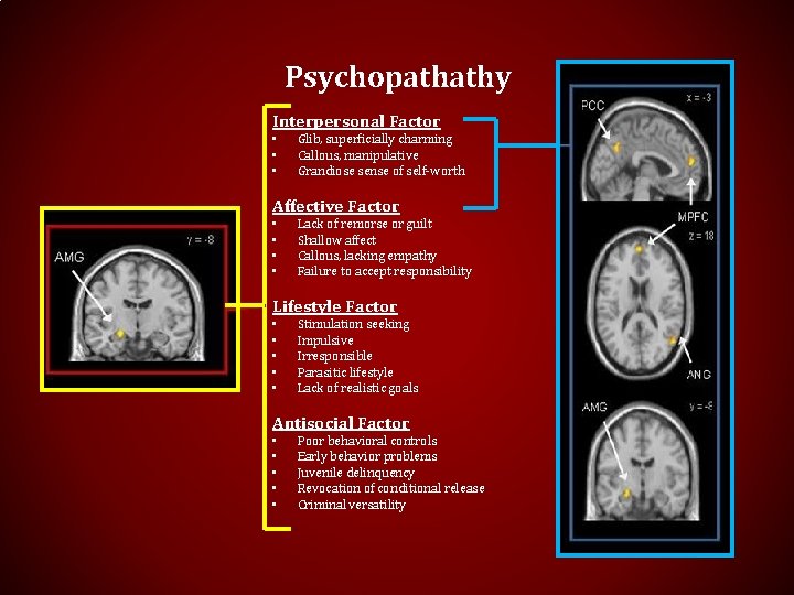 Psychopathathy Interpersonal Factor • • • Glib, superficially charming Callous, manipulative Grandiose sense of