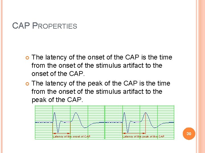 CAP PROPERTIES The latency of the onset of the CAP is the time from