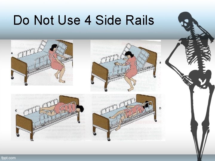 Do Not Use 4 Side Rails 