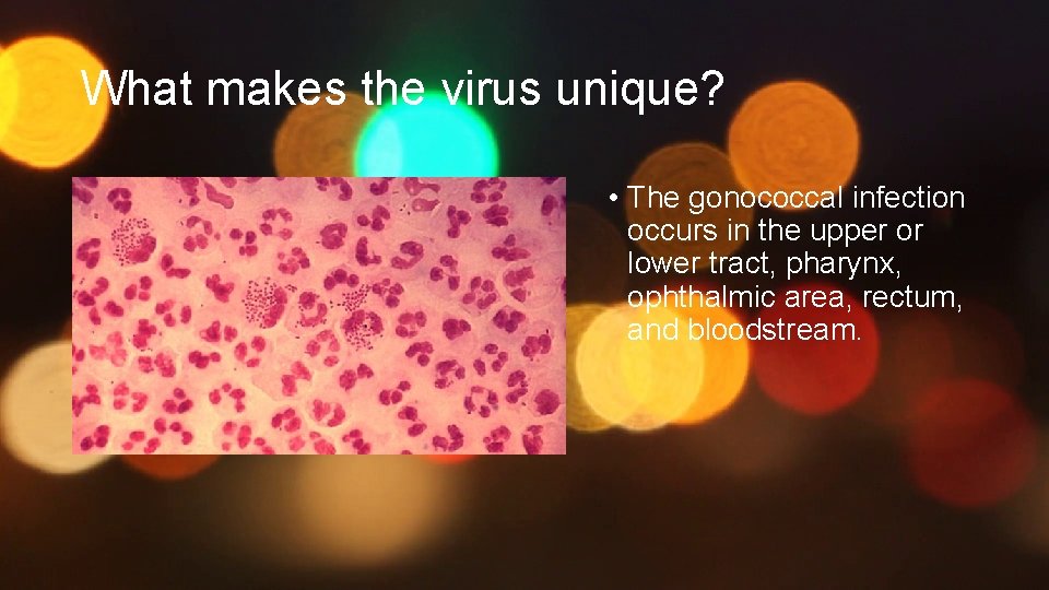What makes the virus unique? • The gonococcal infection occurs in the upper or