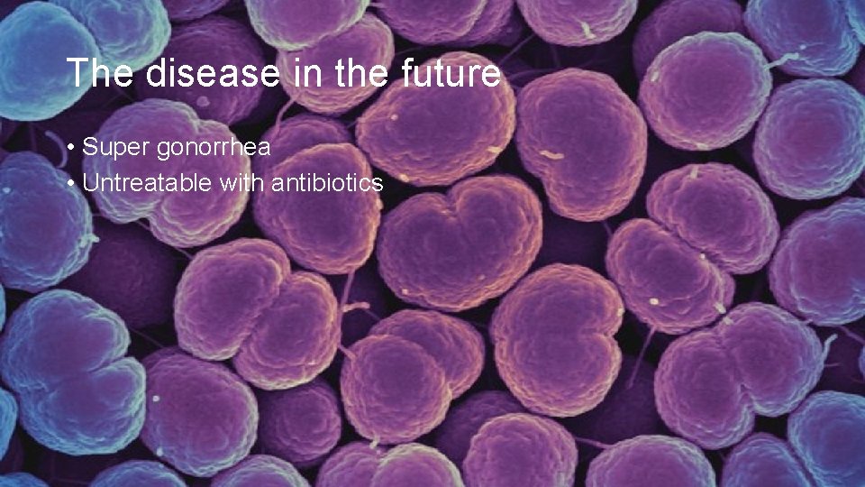 The disease in the future • Super gonorrhea • Untreatable with antibiotics 