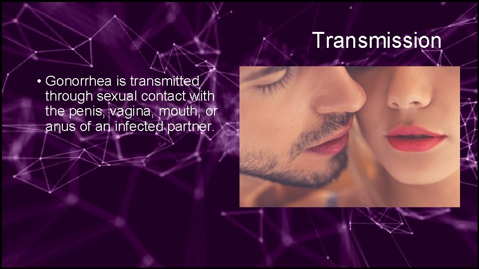 Gonorrhea By Lucas Megan and Jan History Gonorrhea