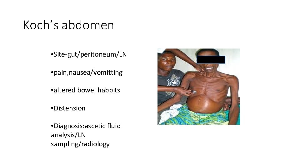 Koch’s abdomen • Site-gut/peritoneum/LN • pain, nausea/vomitting • altered bowel habbits • Distension •