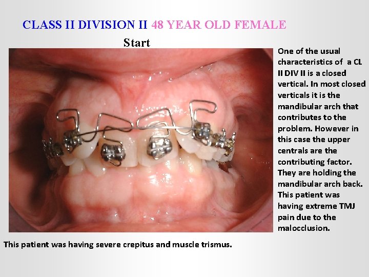 CLASS II DIVISION II 48 YEAR OLD FEMALE Start One of the usual characteristics