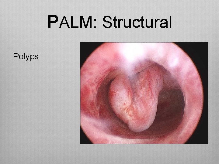 PALM: Structural Polyps 