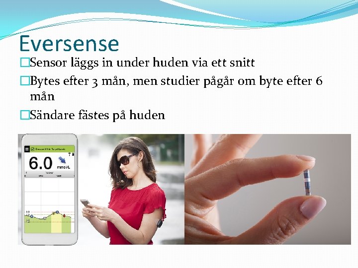 Eversense �Sensor läggs in under huden via ett snitt �Bytes efter 3 mån, men