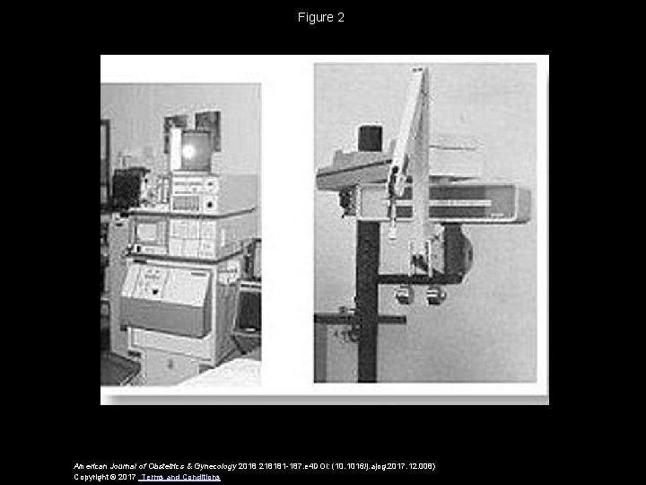 Figure 2 American Journal of Obstetrics & Gynecology 2018 218181 -187. e 4 DOI: