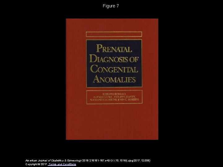 Figure 7 American Journal of Obstetrics & Gynecology 2018 218181 -187. e 4 DOI: