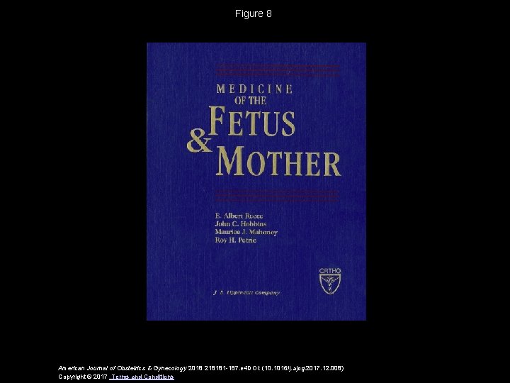 Figure 8 American Journal of Obstetrics & Gynecology 2018 218181 -187. e 4 DOI: