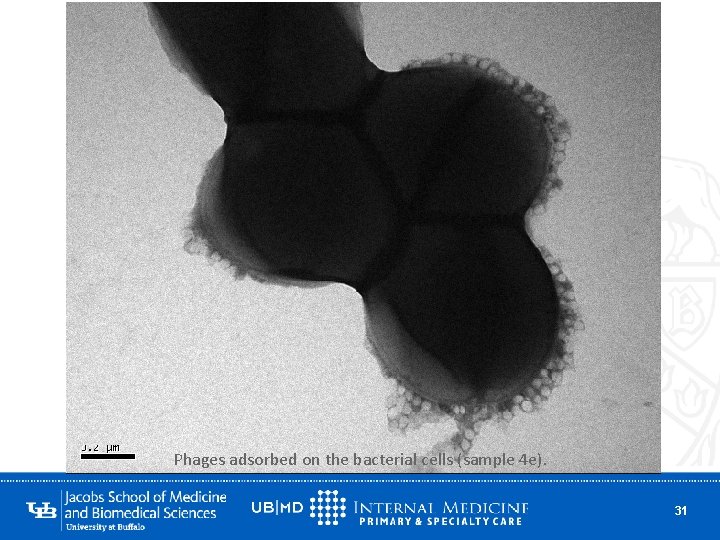 Phages adsorbed on the bacterial cells (sample 4 e). 31 